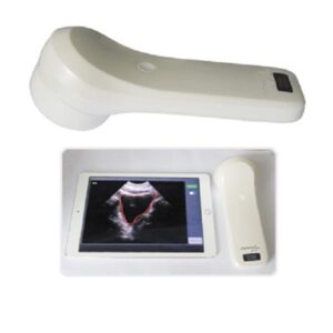 Wireless 4D Portable Bladder Scanner – Handheld Ultrasound Bladder Volume Scanner
