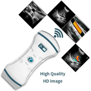 WiFi USB Doppler Ultrasound Scanner (Convex / Linear / Phased)