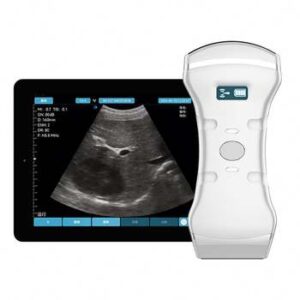 3-in-1 Convex Linear Cardiac Probe Wireless Ultrasound