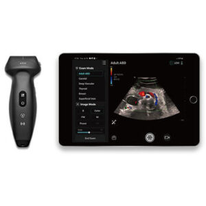 Mindray Wireless Handheld Ultrasound (TE Air E5M Probe)